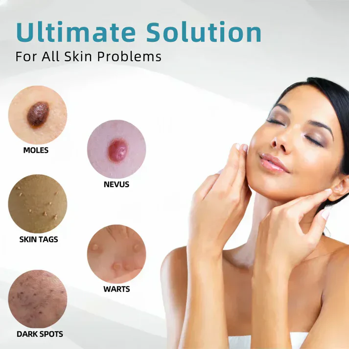 All-in-One CO₂ Laser Eraser Pen | Removes Moles, Warts, Skin Flaws & Pigmentation